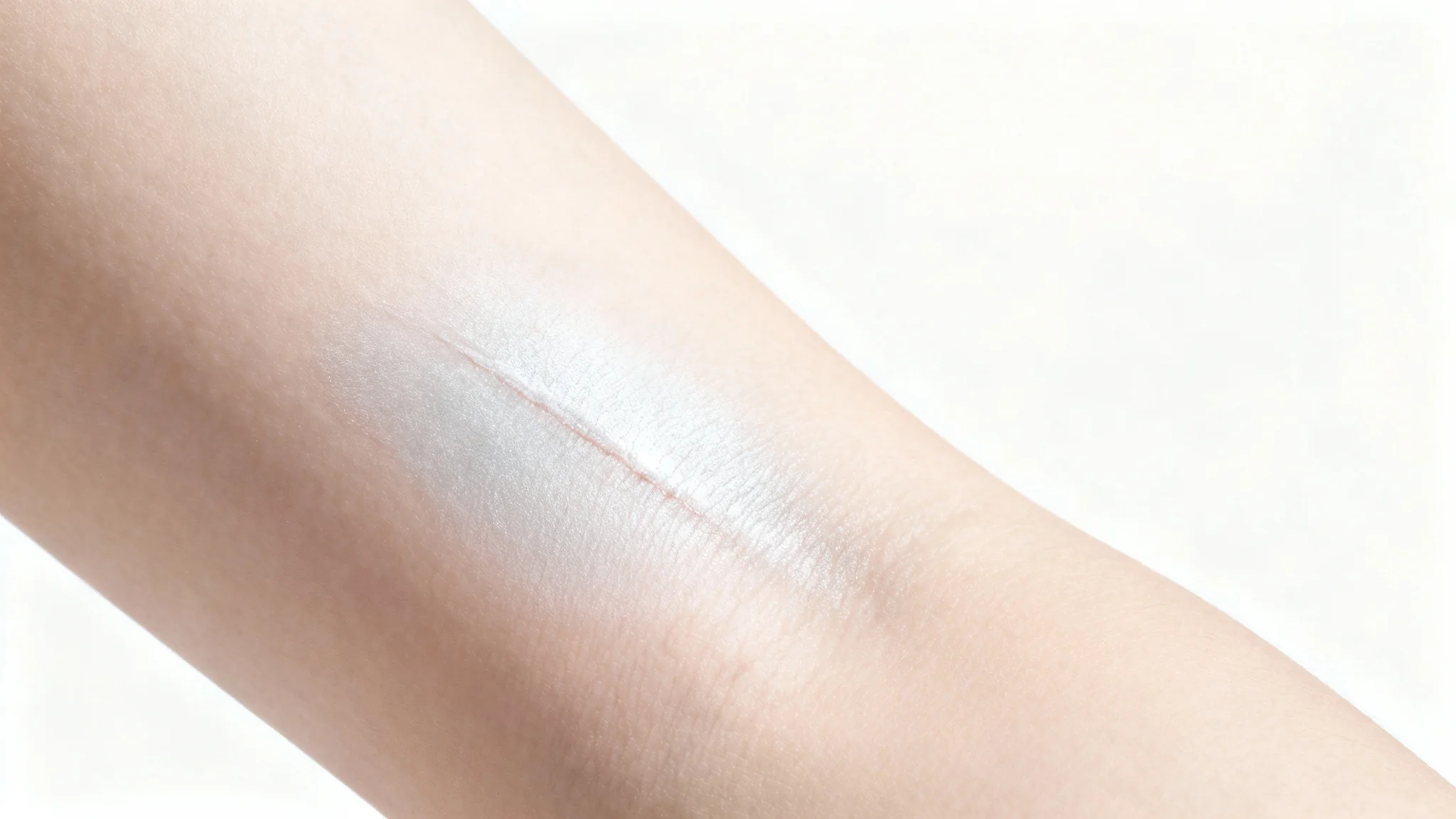 A high-detail, close-up photograph of a faded scar on human skin, symbolizing healing and recovery, set against a clean white background.