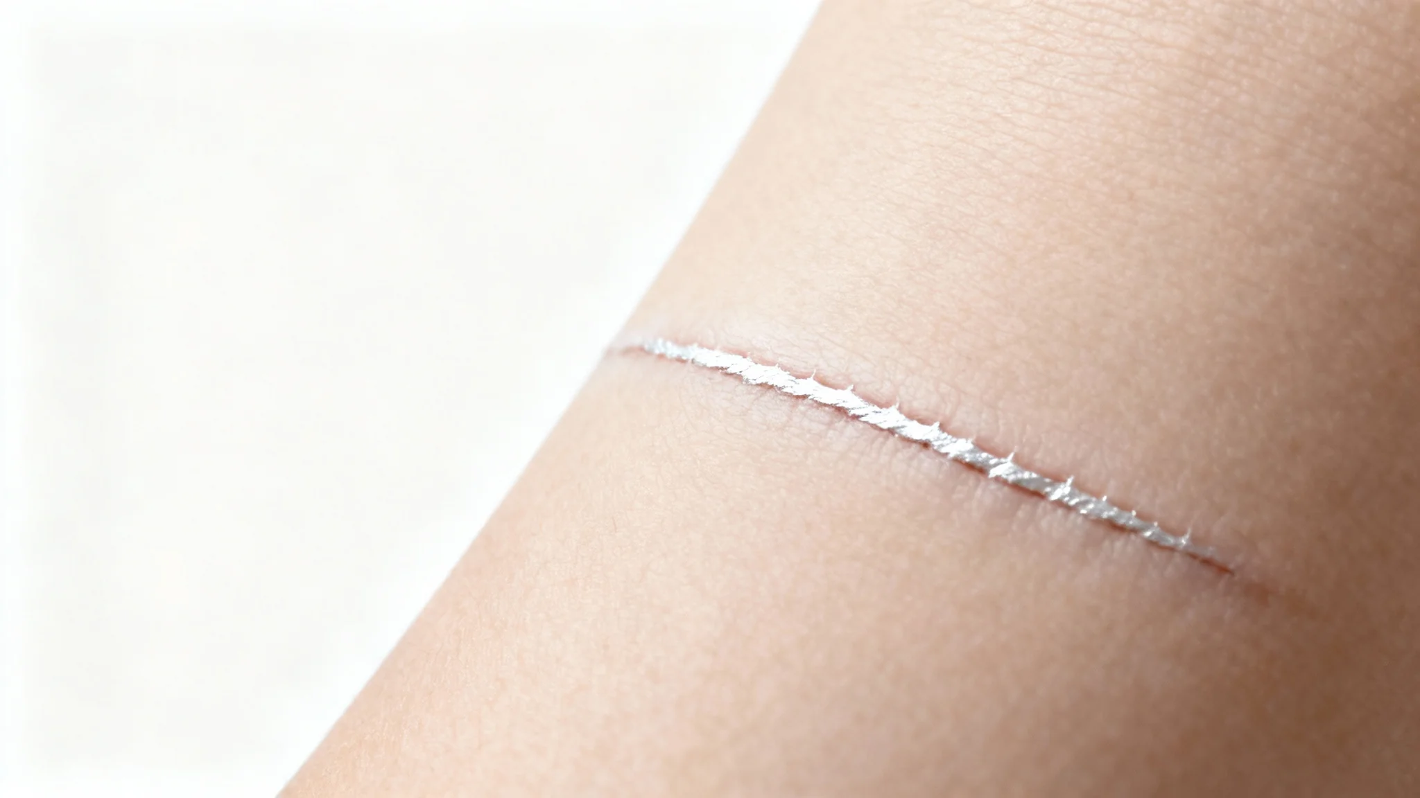 A close-up, photorealistic image of a healed, silvery-white scar on skin, isolated against a clean white background.