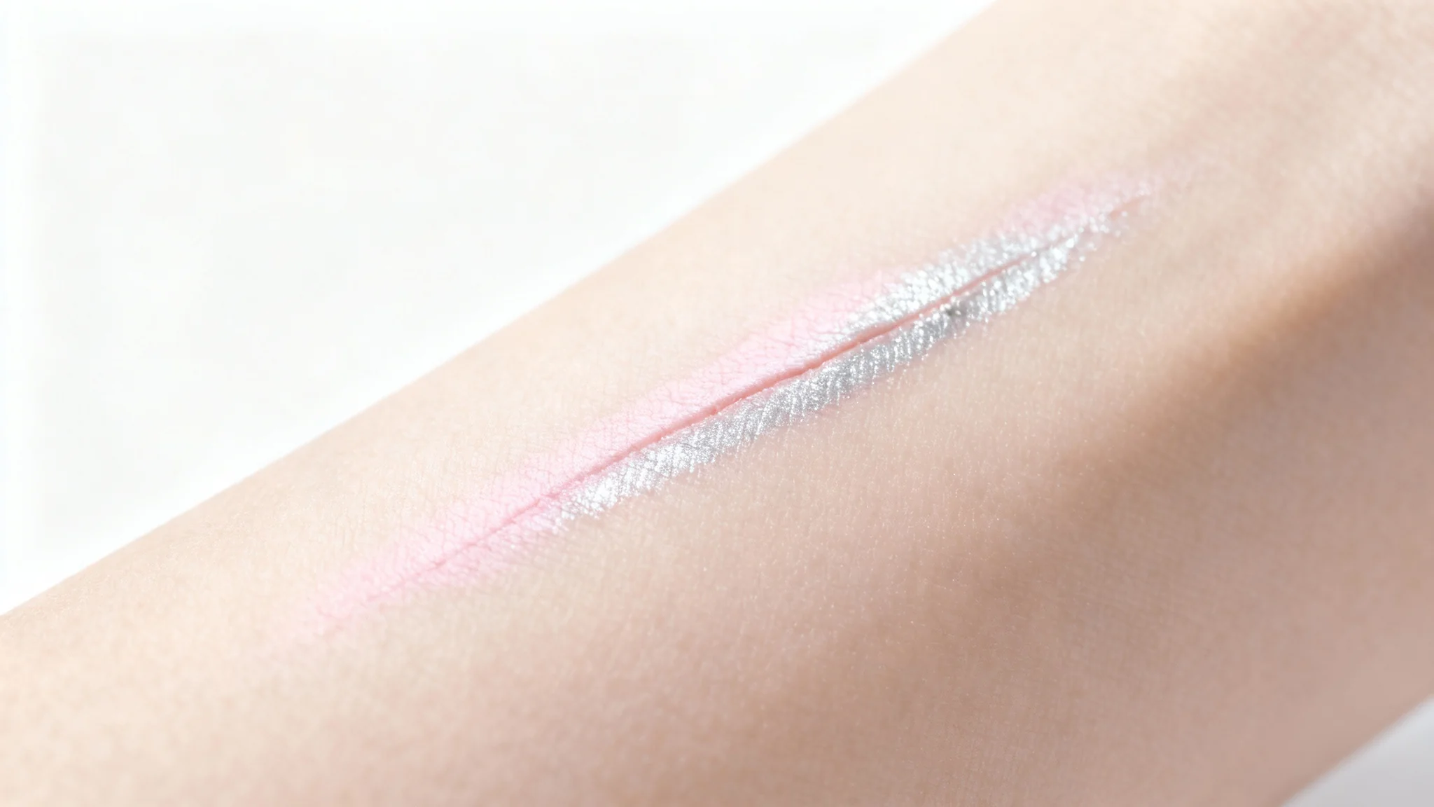 A close-up, clinical-style photograph of a faint, healing scar on human skin, set against a sterile white background to emphasize skin recovery.