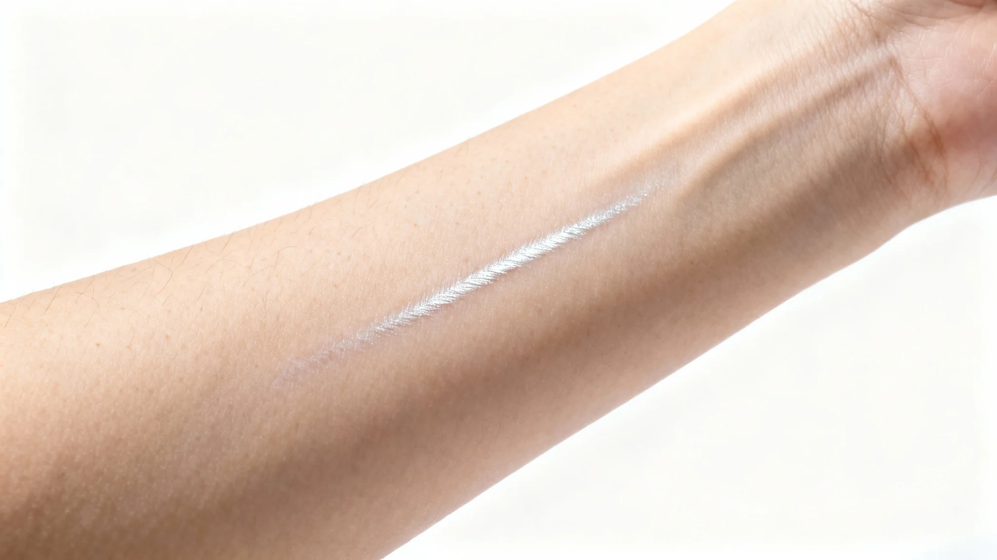 A close-up, photorealistic image of a very faint, faded scar on a person's forearm against a stark white background, illustrating the concept of healing.