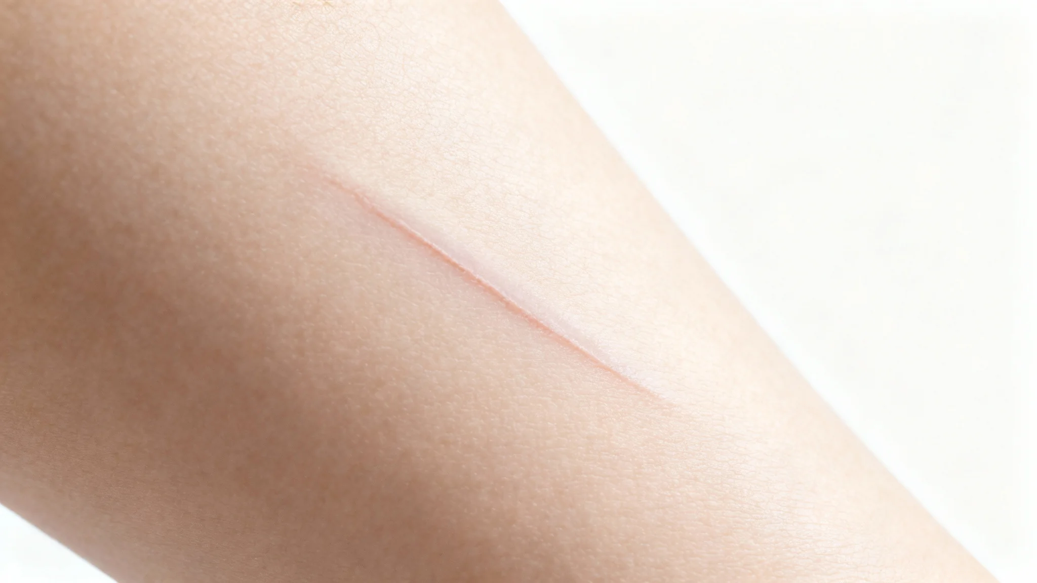A clinical, macro photo of a barely visible, well-healed scar on skin, set against a clean white background, symbolizing effective skin recovery.
