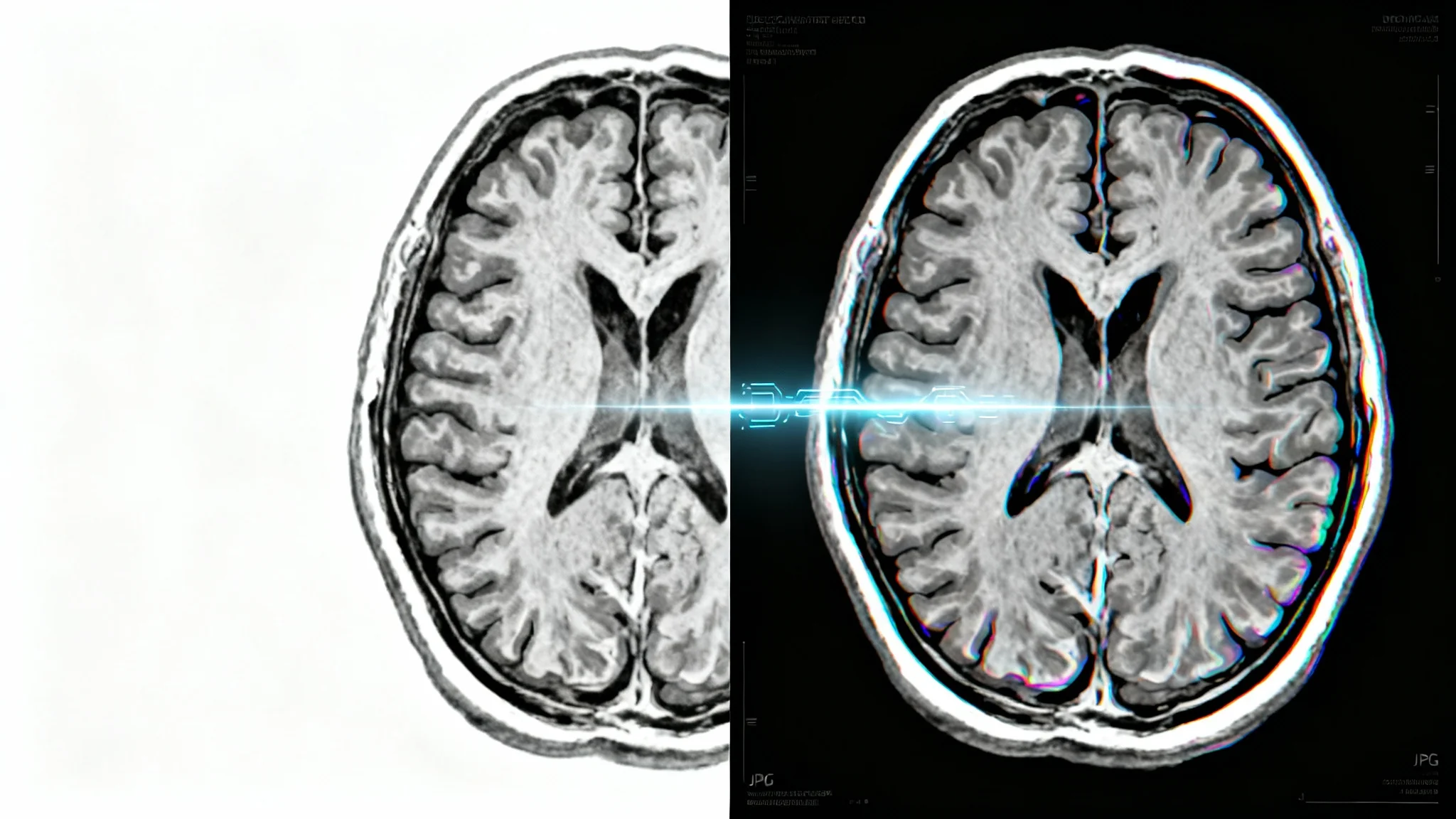 A side-by-side comparison of a medical brain scan, showing the transformation from a complex grayscale DICOM image on the left to a clear, color-enhanced JPG image on the right, against a white background.